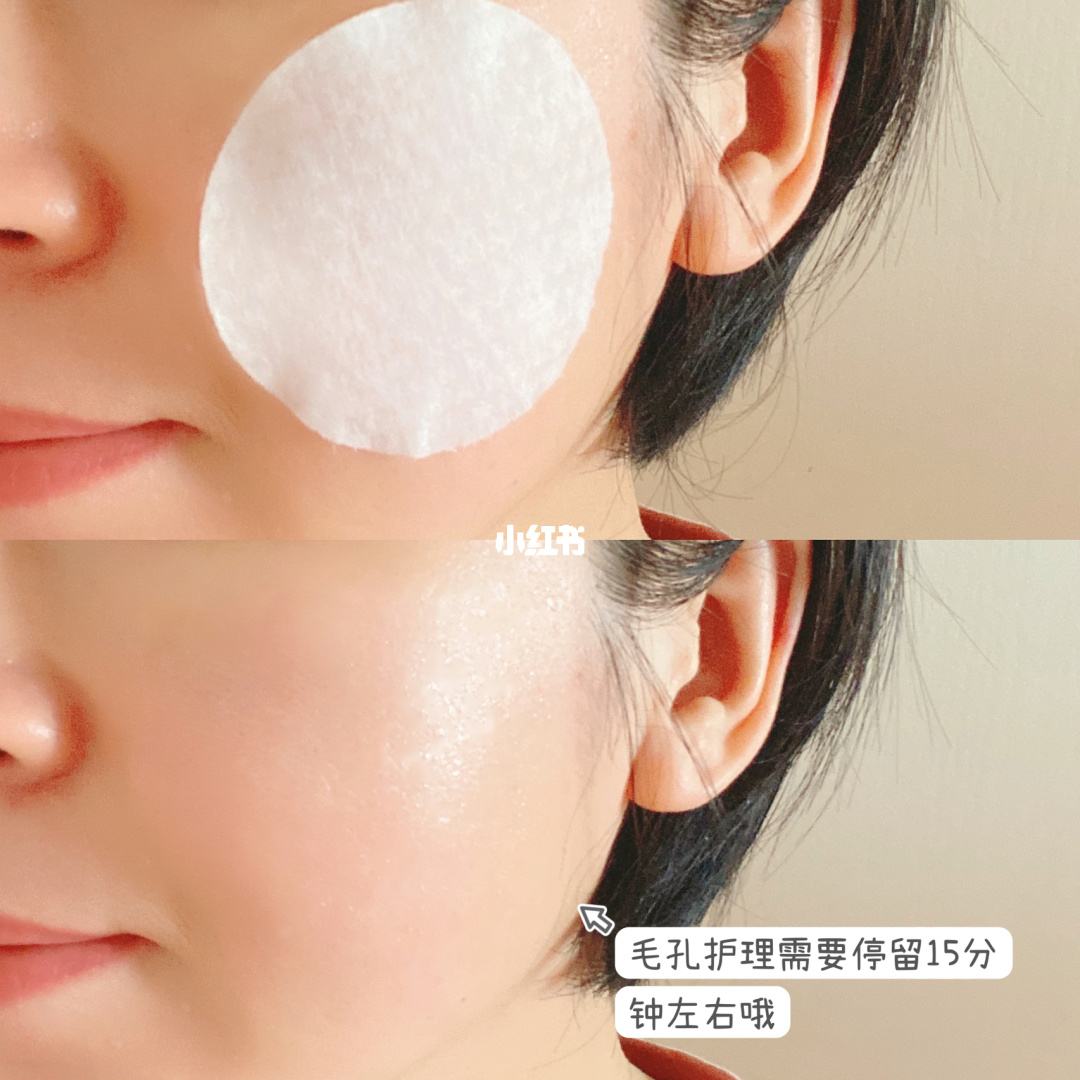 {21點}(外油内干毛孔粗大护肤品推荐平价)
